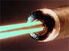 Laser Catheter