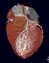 MSCT Scan