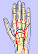 MSCT Scan